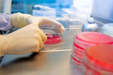 Hands of scientists are working on research.Bacteria in agar sheets, laboratory tests for infection, growth of Gram-negative bacteria, Gram-negative bacteria, Gram-positive bacteria, alpha