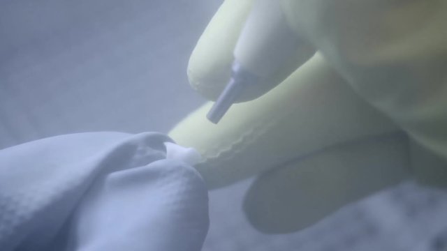 Dental technician polishing artificial ceramic teeth using sandblaster in the dental lab. Professional wearing gloves while holding fake teeth in hand and polishing it with sand blaster