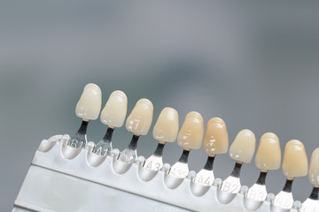 Close up of shade guide to check veneer of teeth for bleaching - obrazy, fototapety, plakaty