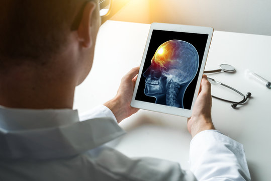 Doctor holding a digital tablet with x-ray of spine with pain on the forehead and brain. Migraine and headache concept