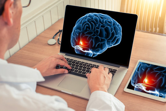 Doctor watching a laptop with x-ray of a brain with pain relief in the front in a medical office