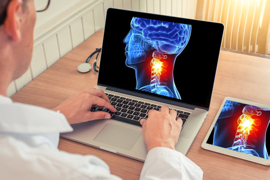 Doctor watching a laptop with x-ray of a 3D skull head with pain relief in the neck in a medical office. Headache migraine concept