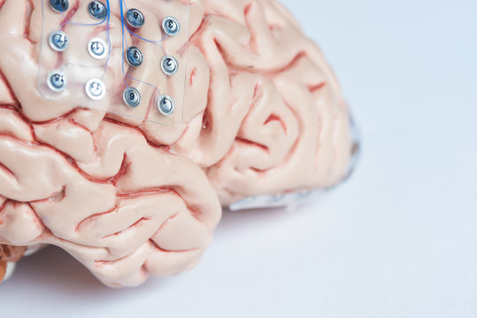 Brain waves recording electrodes on brain model surface