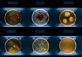 different samples with kinds of bacterias living at common household items- mattress, shoe,...