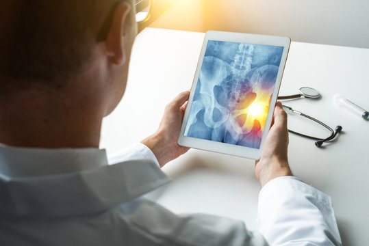 Doctor holding a digital tablet with x-ray of hips with pain in the right