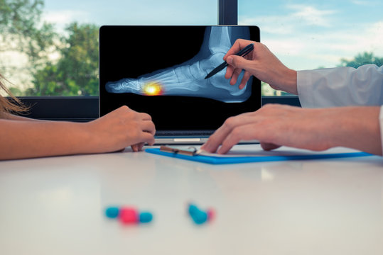 Doctor Showing A X-ray Of A Foot With Pain Under On A Laptop To A Woman Patient. Pills On The Desk