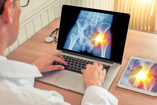 Doctor watching a laptop and a digital tablet with x-ray of hips with pain relief on the right in a medical office