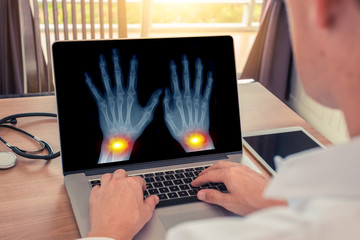Doctor watching a x-ray of hands with pain in the wrists. Radiology and osteoarthritis concept