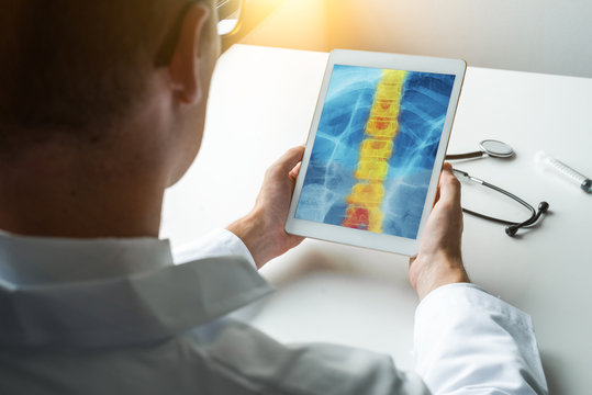 Doctor holding a digital tablet with x-ray of spine with pain