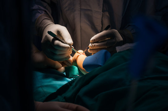 Manos de doctor cirujano en cirug&iacute;a