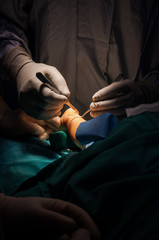 Cirujano operando pie de niño
