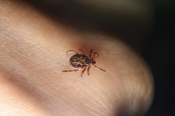 Forest mite on the skin. wood tick