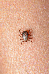 Forest mite on the skin. wood tick
