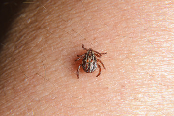 Forest mite on the skin. wood tick