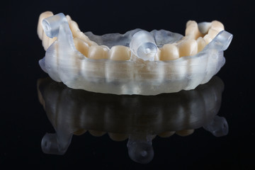 Fototapeta na wymiar dental template for transferring a temporary prosthesis after implantation on six implants