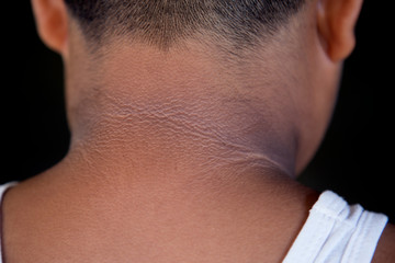 The child with the back of the black neck.