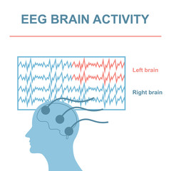 Fototapeta premium EEG Brain Activity