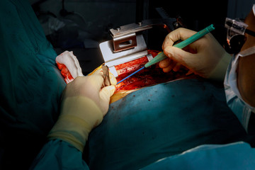 The process of cardiac surgery surgical instruments for open heart surgery