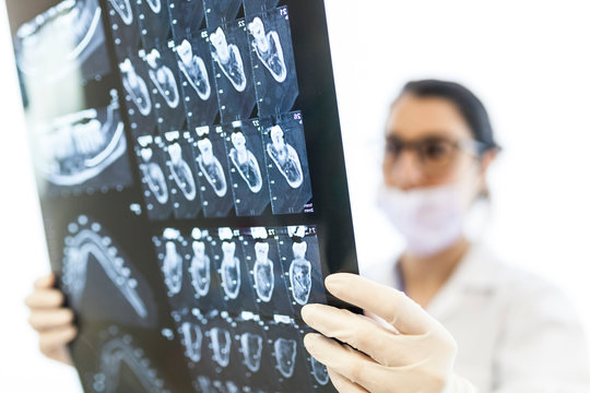 female dentist reviewing the patient's x-ray