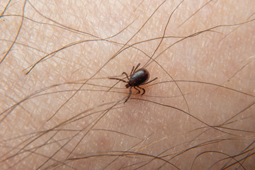 Forest mite on the skin. wood tick