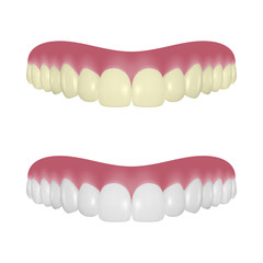 Vector 3d Realistic Render Denture Set Closeup Isolated on White Background. Dentistry and Orthodontics Design. Human Teeth for Medical and Toothpaste Concept. Healthy Oral Hygiene, Jaw Prosthesis