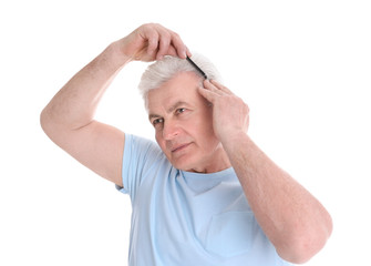 Senior man with hair loss problem isolated on white