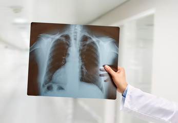 holding a lungs radiography