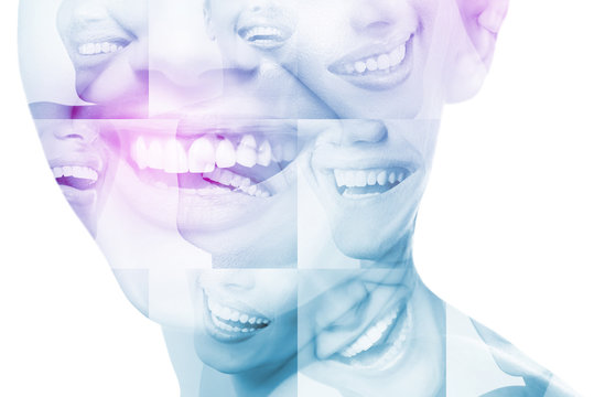 Laughing women and man with great teeth over white background. Healthy beautiful male and female smile. Teeth health, whitening, prosthetics and care. Set of perfect smiles. Happy people, detail