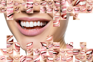 Laughing women and men with great teeth over white background. Healthy beautiful male and female smile. Teeth health, whitening, prosthetics and care. Set of perfect smiles. Happy people, detail.
