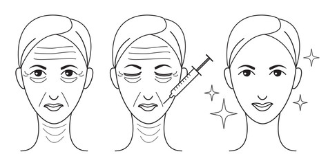 Botox line woman face set