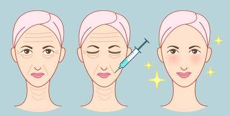 Botox woman face set