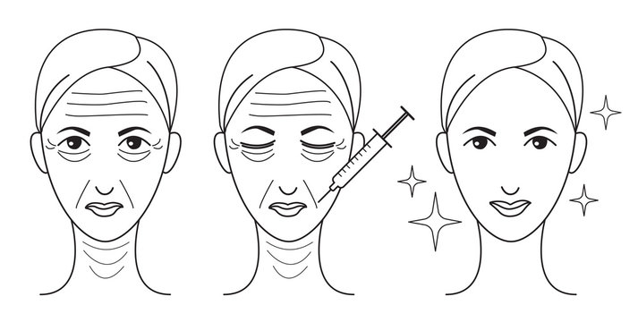 Botox Line Woman Face Set