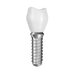 Tooth Implant on white isolated background. 3D rendering
