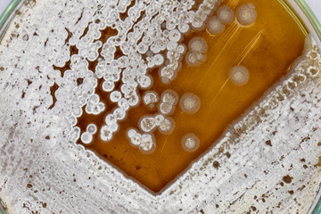 Study Colony characteristic of Actinomyces, Bacteria, yeast and Mold on selective media from soil samples for study in laboratory microbiology.