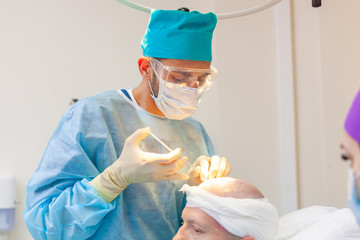 The surgeon gives injections to the head. Baldness treatment. Hair transplant. Surgeons in the...