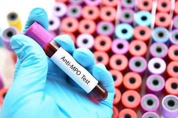 Obraz premium Test tube with blood sample for anti-MPO test