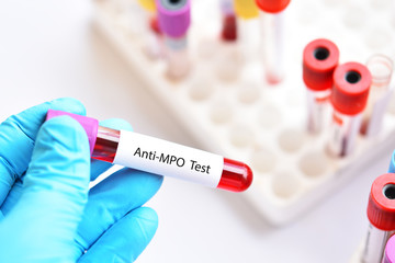 Test tube with blood sample for anti-MPO test