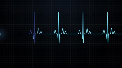 Loopable: Blue EKG/ECG cardiogram oscilloscope monitor heartbeat line chart shows 60 BPM heart rate on black background with grid.