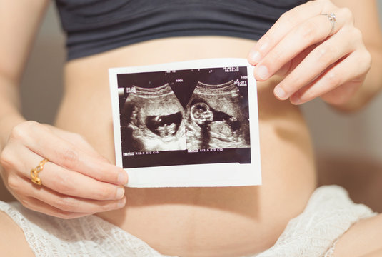Young pregnant woman looking at 16 Weeks x-ray ultrasound scan of baby