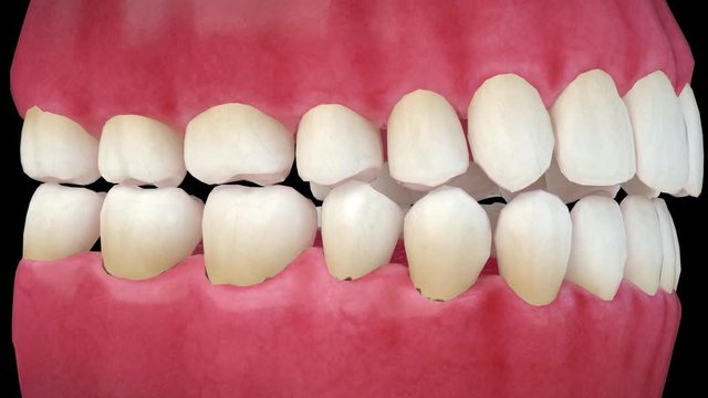 teeth and gums