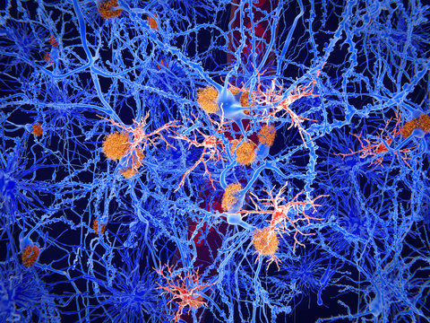 Microglia cells (red) play an important role in the pathogenesis of Alzheimer´s disease