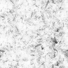 Microorganisms and various bacteria causing human disease under strong microscope magnification