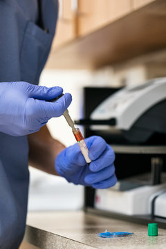 Clinic: Male Tech Running Blood Tests On Patient Sample