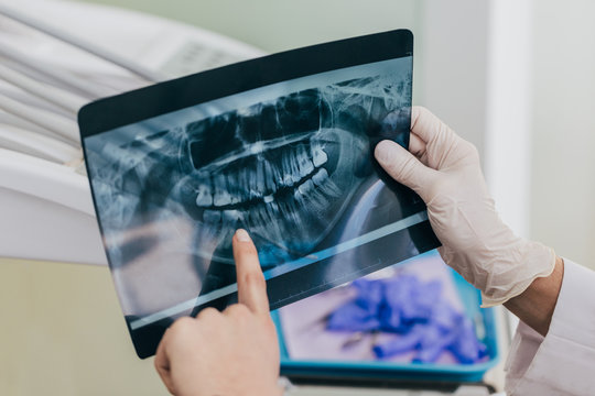 Doctor checking a dental x-ray
