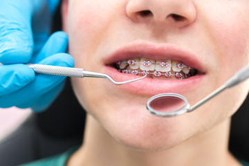 dentist looking at the mouth with tools and mirror