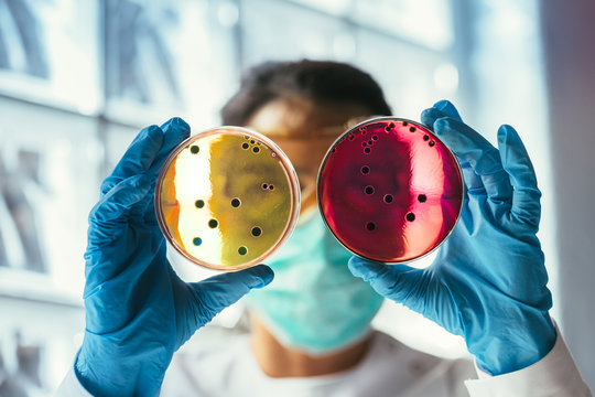 Woman working with petri dishes in the lab