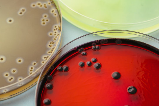 Macro shot of petri dish with microbiology culture