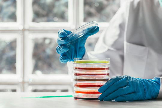 Woman working with petri dishes in the lab