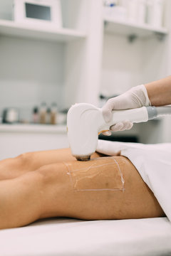 Laser treatment for skin resurfacing at spa center