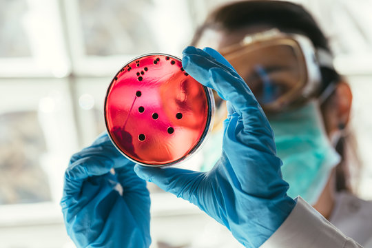 Woman working with petri dishes in the lab